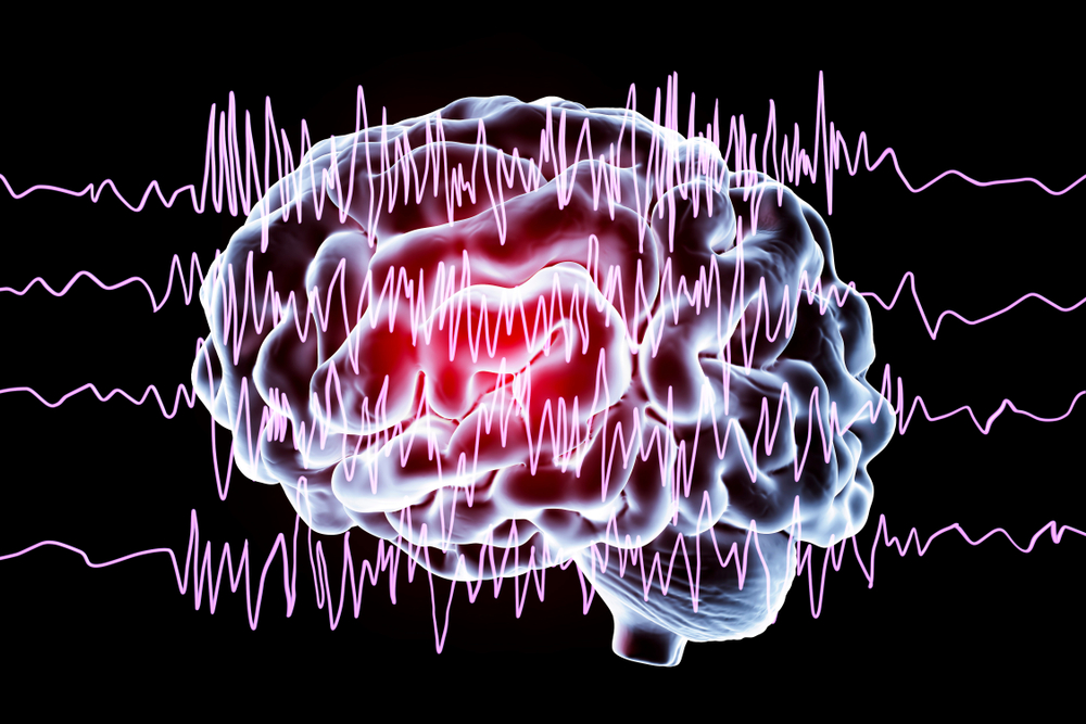 MindStream - NeuroSky EEG Data Streamer
